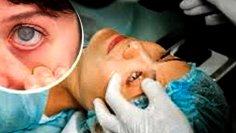 DEBUNKING MYTHS: CATARACT SURGERY & SUMMER