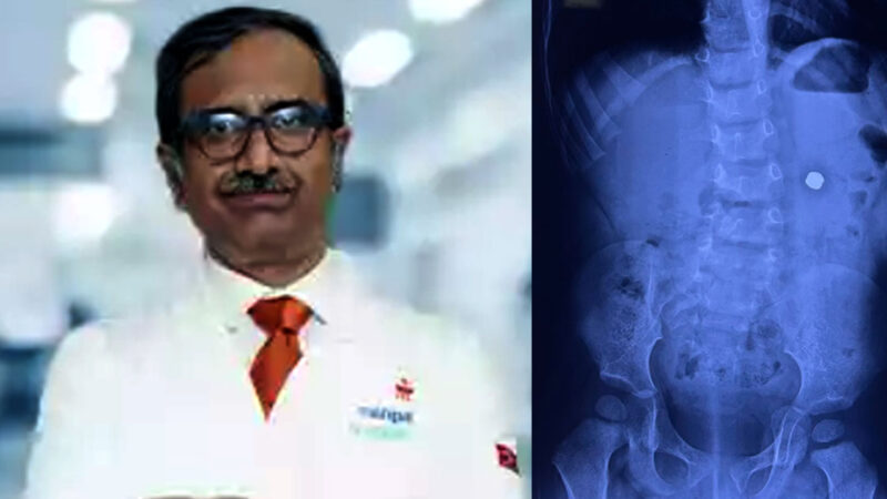 Race against time: 19-month-old Agastya saved by scarless surgery after swallowing magnetic battery by Manipal Hospital Mukundapur